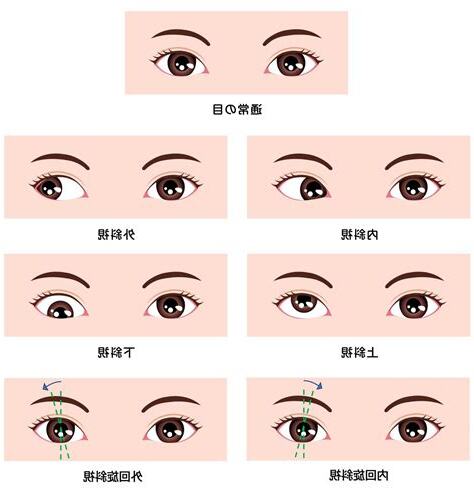 斜視