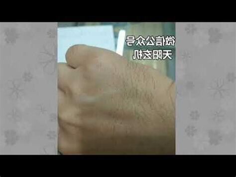 手上長毛
