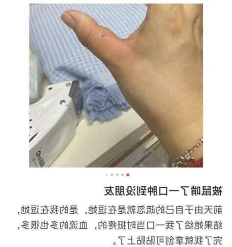被老鼠咬到