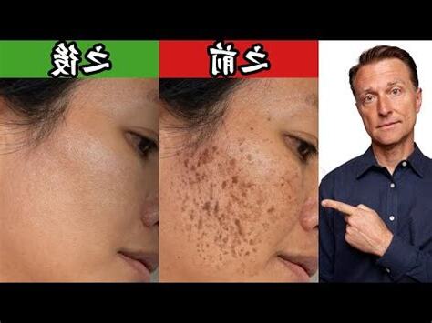 脖子斑點