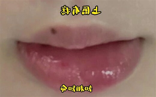 上唇有痣男