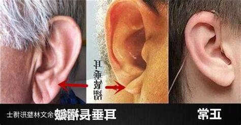 耳垂形狀