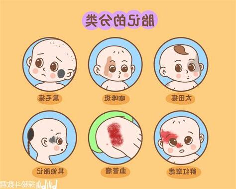 胎记种类
