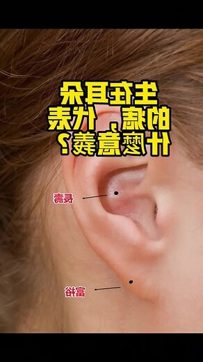 耳痣位置