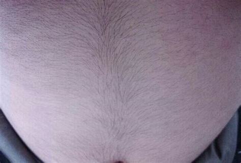身體突然長毛
