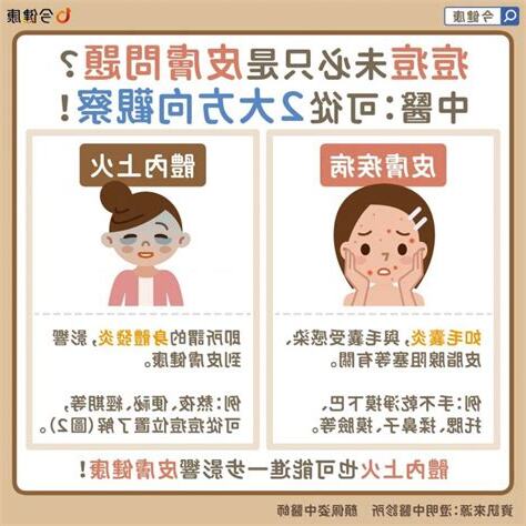痘痘長的地方