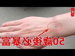 左手手腕有痣
