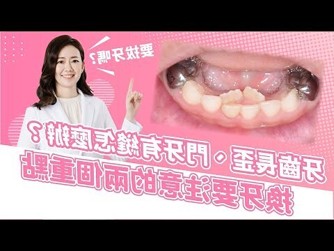 牙齒門牙