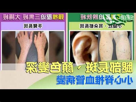 耳朵黑斑