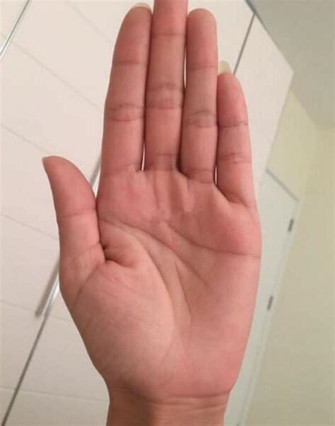 中指彎向無名指
