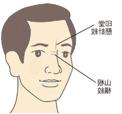 橫紋鼻子上有一條線