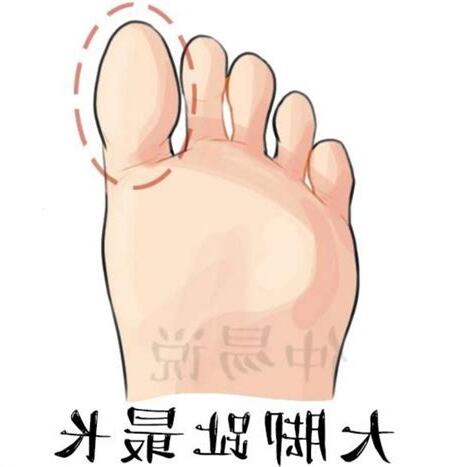 腳趾看命