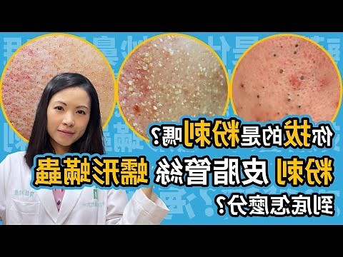 臉上白毛可以拔嗎