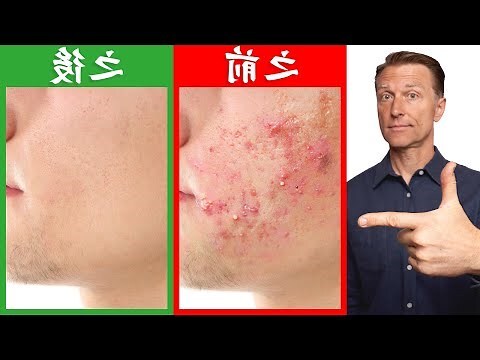 臉上長一根很長的毛