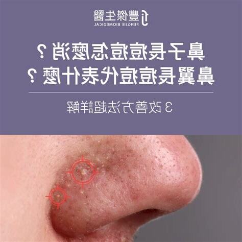 鼻頭長痘痘代表什麼