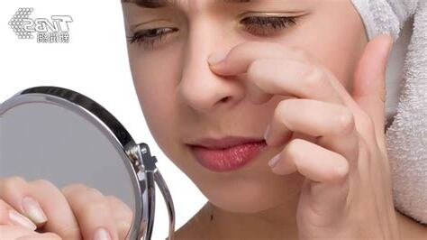 鼻頭長痘痘破財