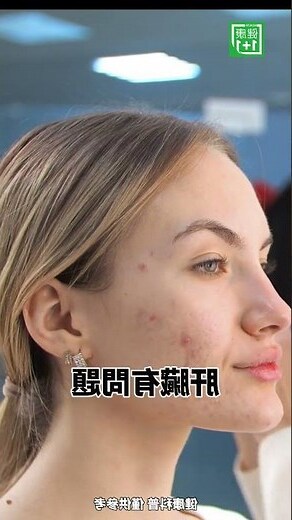 眉毛上面長痘痘