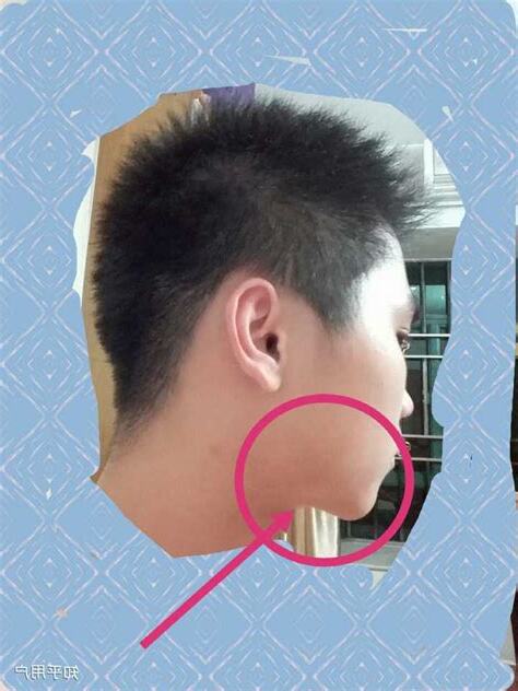 腮骨大男