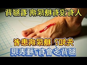 腳背長毛