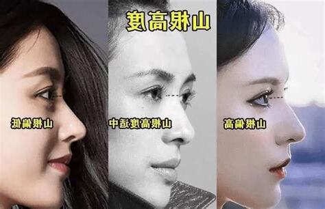 鼻子低