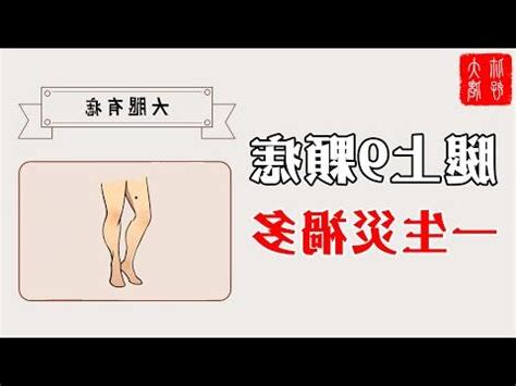 大腿後側有痣