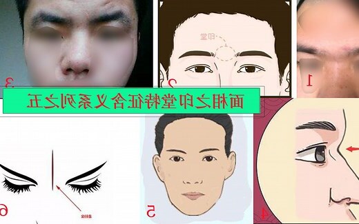 印堂發紅怎麼辦