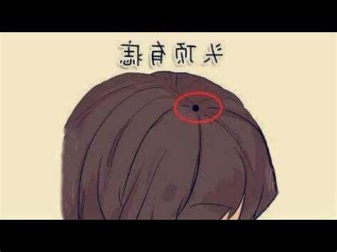 頭髮側邊有痣
