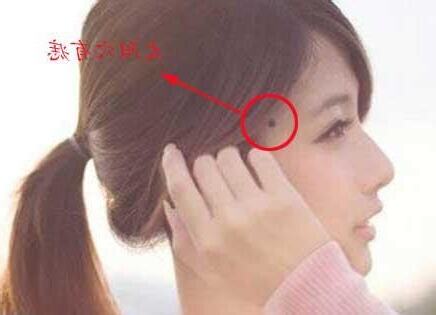 左太陽穴有痣女