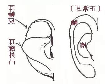 耳骨面相