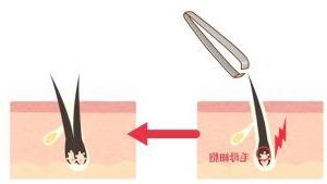 應毛