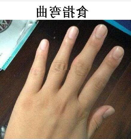 食指彎曲