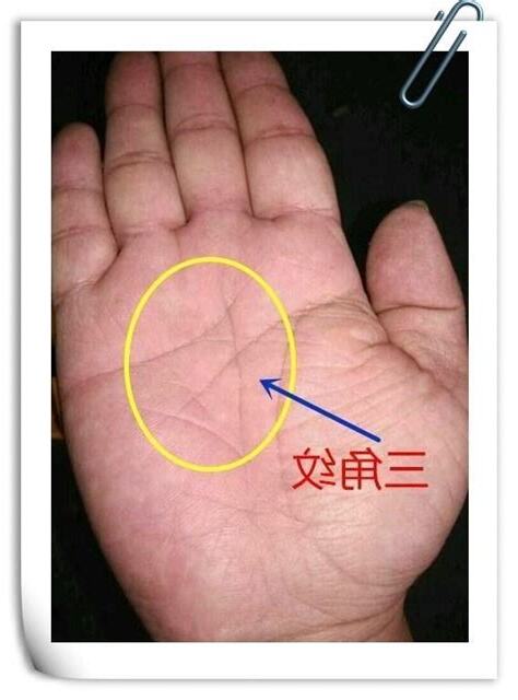 無名指下三角紋