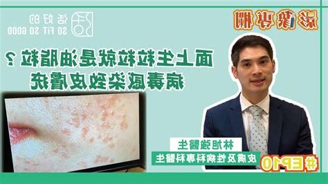 面上生白毛