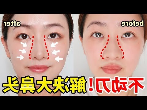 垂肉鼻