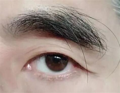 右眉毛長一根長毛