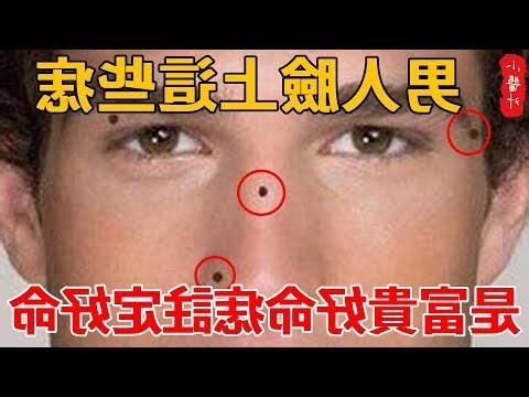 男生脸痣