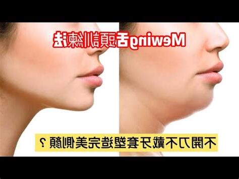 上顎突出面相