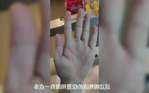 活痣和死痣