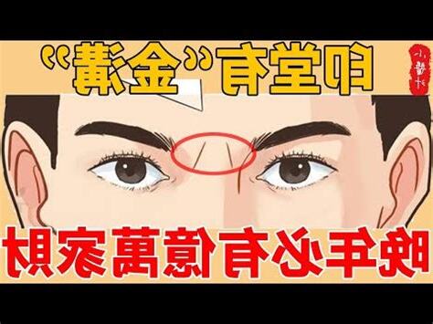 印堂有金溝