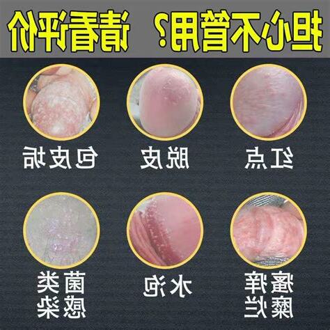 龜頭一顆顆