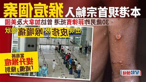 猴痘香港