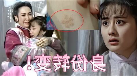 公主的胎記