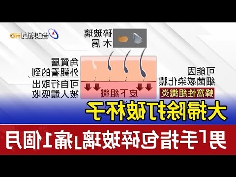 打破杯子預兆