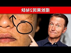 臉上的斑點