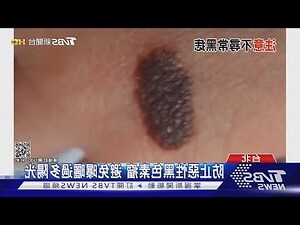 腋下長痣