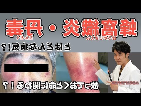 蜂窩現象