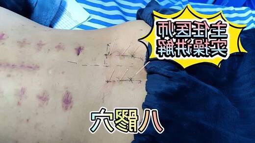 八廖穴