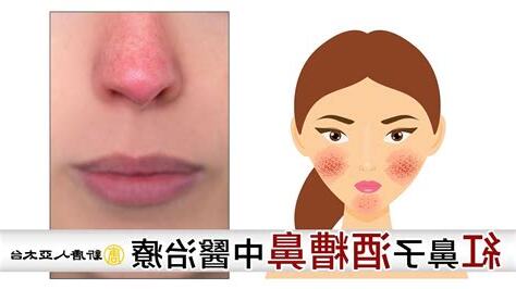 鼻子突然紅紅的