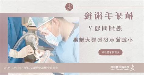 小細節大影響