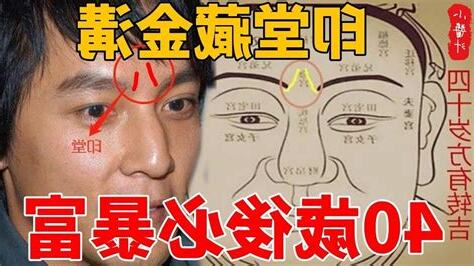 印堂金溝